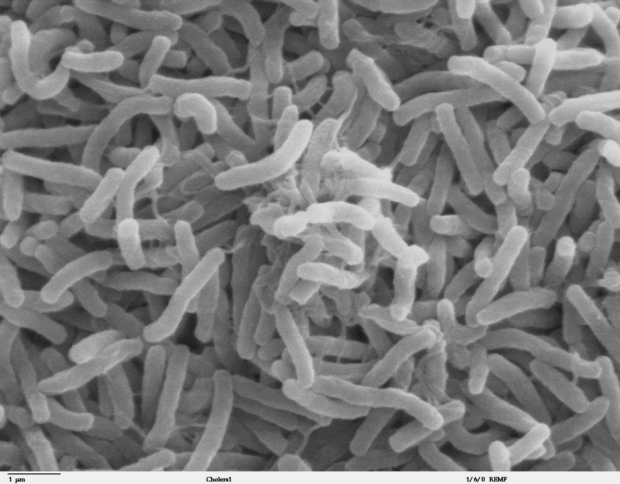 https://medyc.net/wp-content/uploads/2020/11/Cholera_bacteria_SEM.jpg