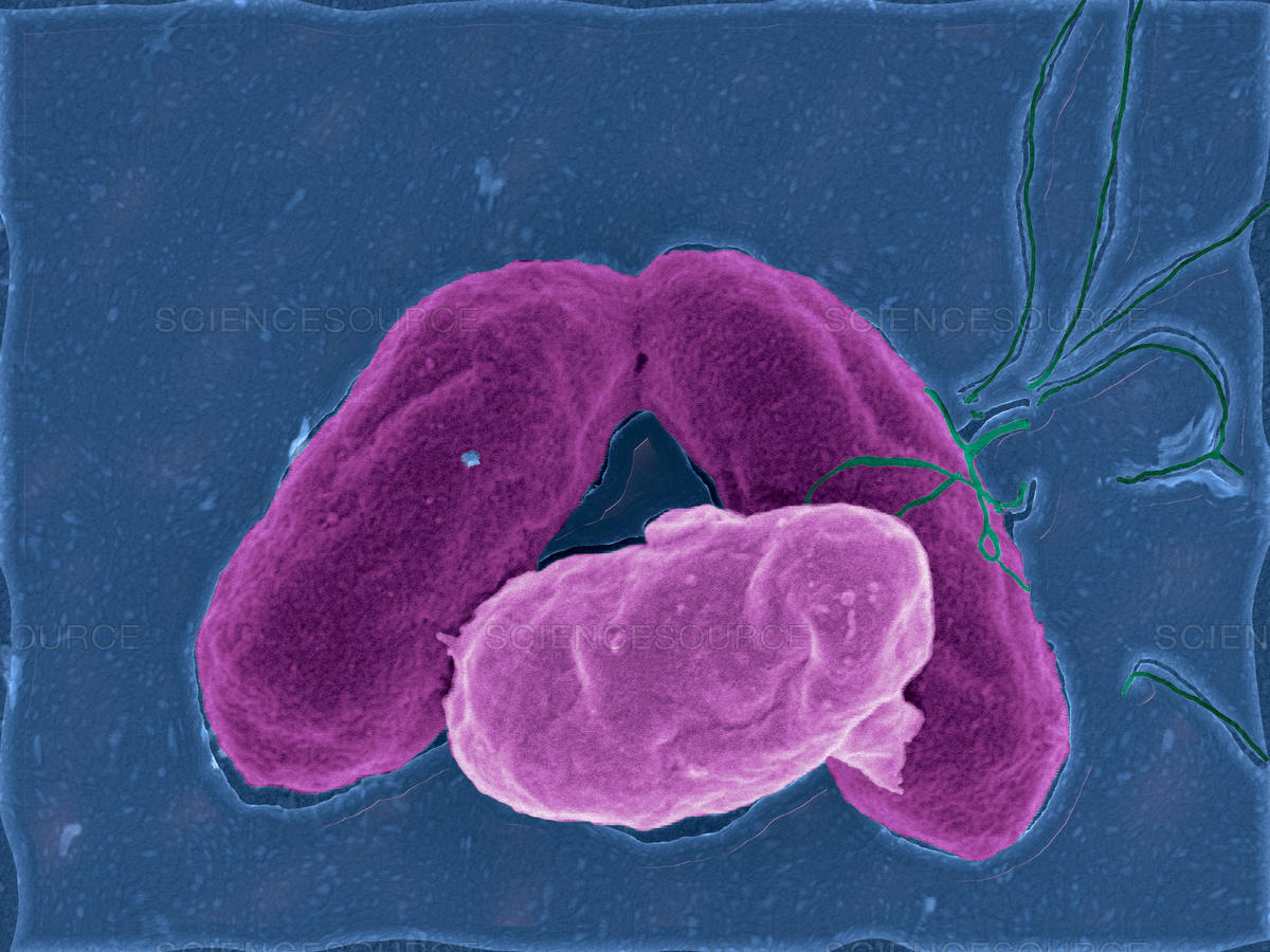 Paratyphoid: przyczyna, objawy i leczenie