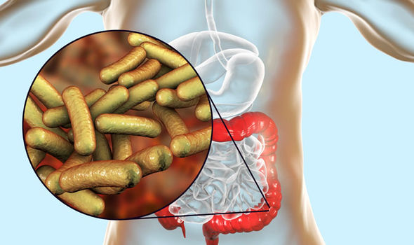 Objawy Shigelli: Infekcja bakteryjna żołądka