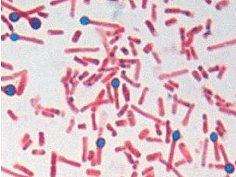 za.  Zarodniki i bakterie Clostridium tetani o typowym kształcie pałeczki bębnowej wyizolowane ze skorupy rany po rogowaceniu w przypadku 1 (barwienie grama-1000x). 