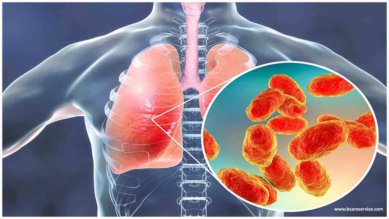 Bakteryjne zapalenie płuc: objawy i leczenie
